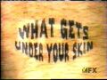What Gets Under Your Skin?